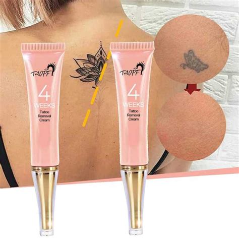 tattoo removal amazon|best tattoo removal cream reviews.